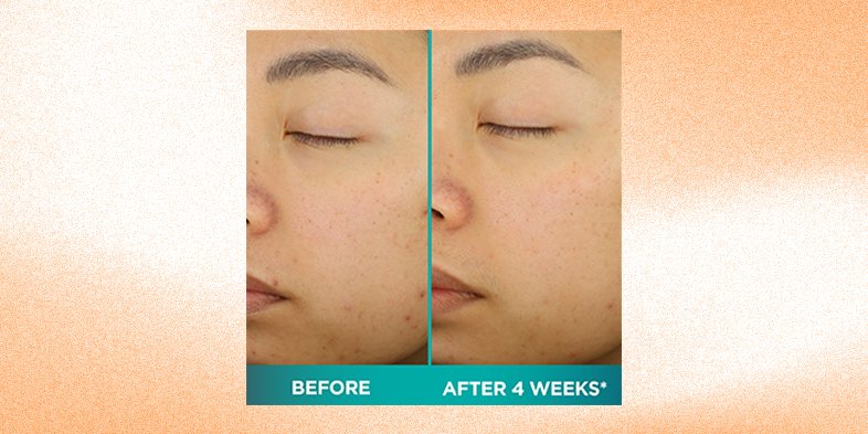 InArticleskinbrighteningtipsBright Reveal Exfoliating Peel Bright Reveal Exfoliating Peel Bright Rev